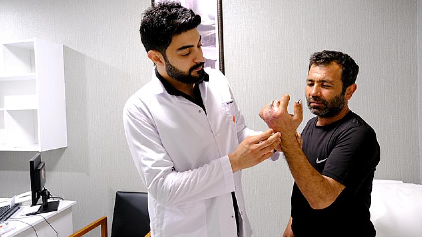 Parçalanan el kesilmekten kurtarıldı